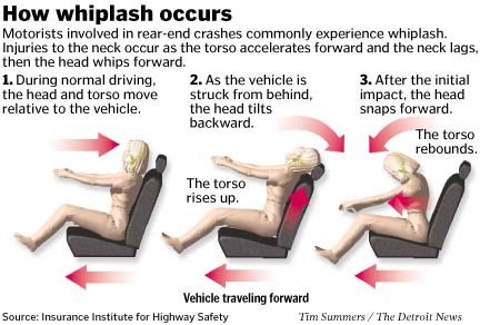 How whiplash occurs